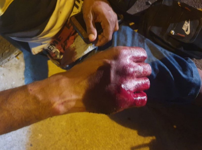 Homem sofre tentativa de homicídio enquanto caminhava na rua, em Ji-Paraná