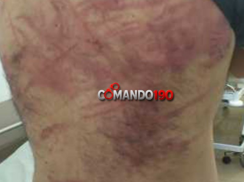 Homem é agredido com fio por dupla em motocicleta próximo à pista de kart