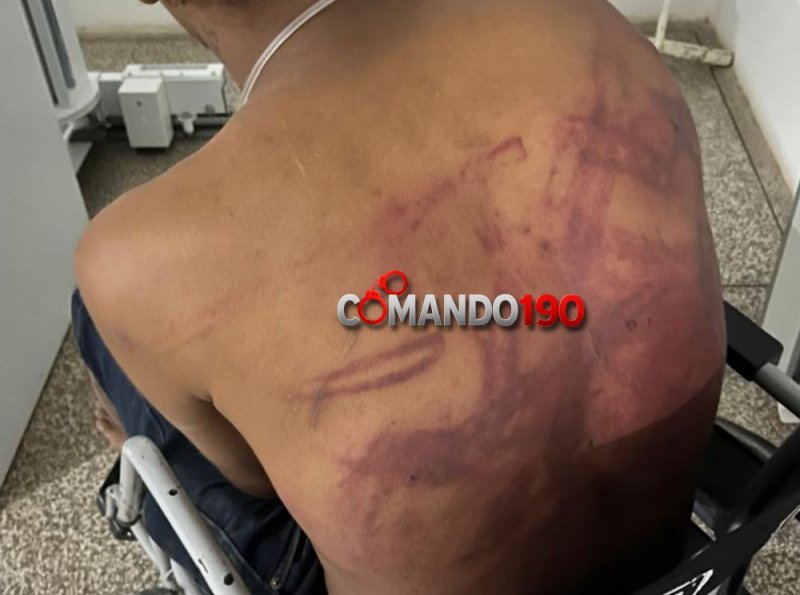 Surra de Cinco: um só apanhou! Homem é agredido com várias pauladas em Ji-Paraná