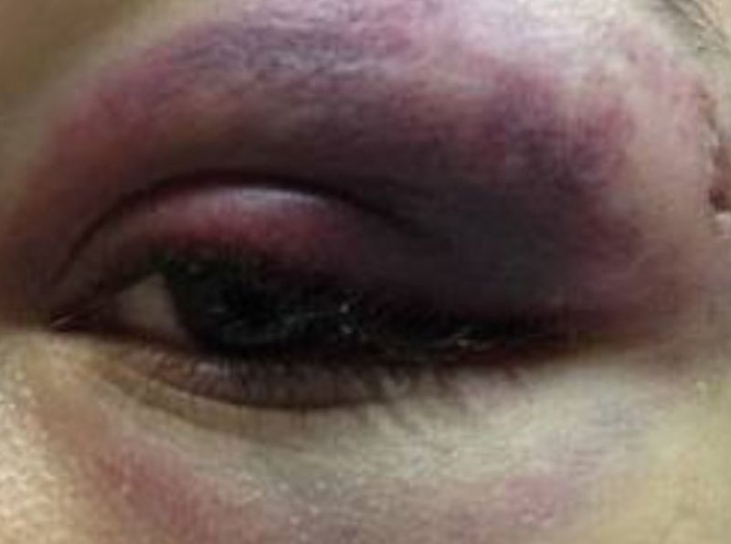 Mulheres ficam feridas após briga em casa de shows no Setor Chacareiro